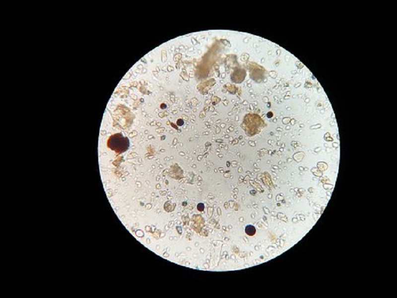 Il suolo al microscopio